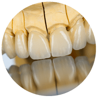 image-340218-periodontologia2.png