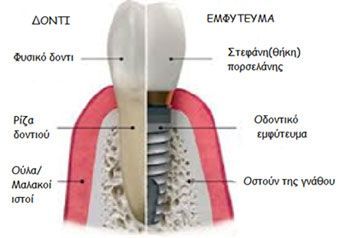 image-340184-prosthetiki1.jpg