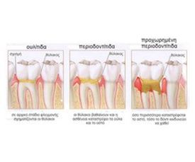 image-340167-periodontologia.jpg